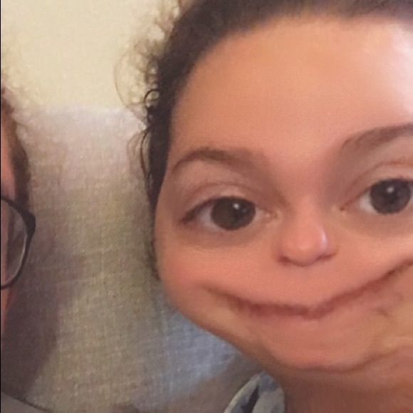 fraca1ca